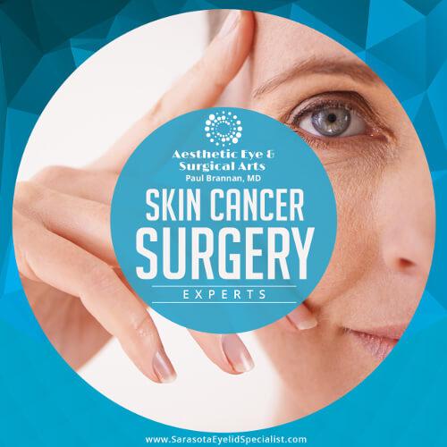 Skin Cancer Surgery